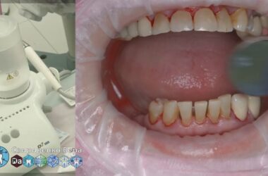 Professional-Dental-Hygiene-DTE-D7-LED-FHD-multistream